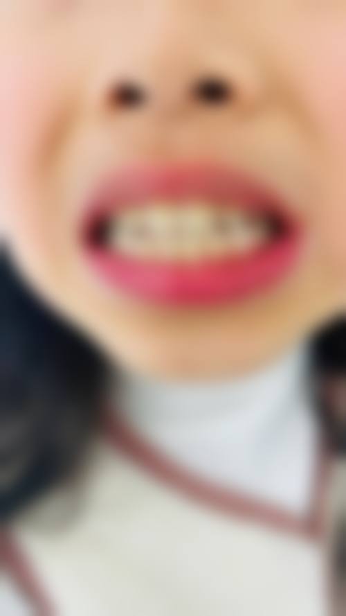 云南大学附属医院口腔医学中 心(口腔正畸科)擅长项目有哪些？