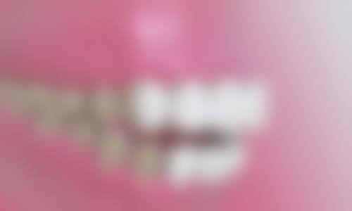 淄博高青史东口腔诊所2026价格表参考