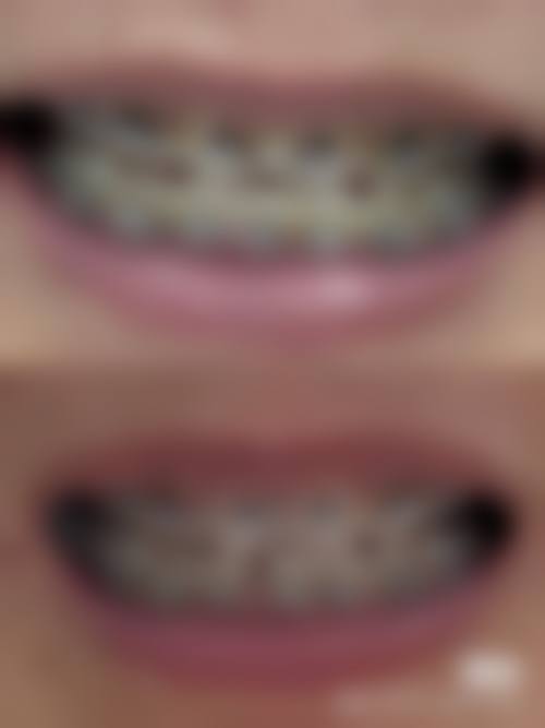 广州市乐嘉口腔医生团队解析