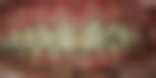 佛山雷媛婷口腔口碑评价