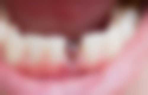 张怡琳预约方式及价格表