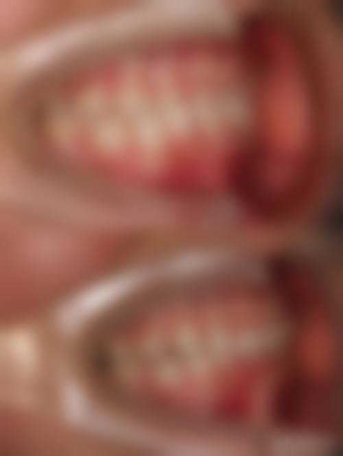 重庆八益牙科2026价格表参考