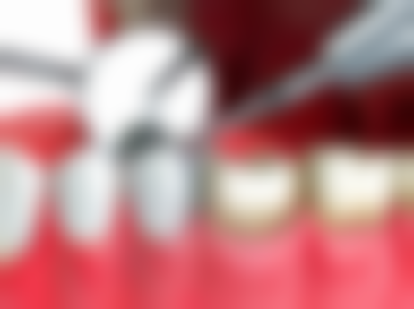 玉林市拜铂口腔门诊部(旺茂连锁)擅长项目有哪些？