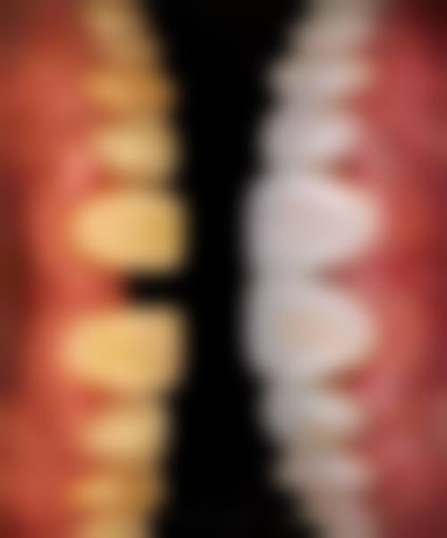 江苏沭阳金铂利口腔擅长项目有哪些？