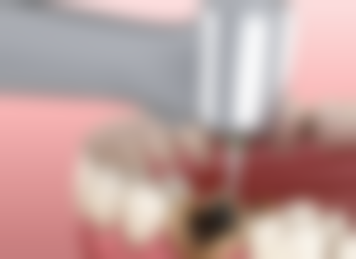 上海泰康拜博广尔口腔门诊部医生团队解析