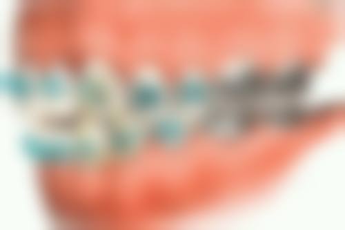 南京牙一生口腔门诊部医生团队解析