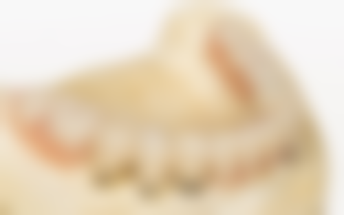 河池市甜美微笑口腔门诊部擅长项目有哪些?