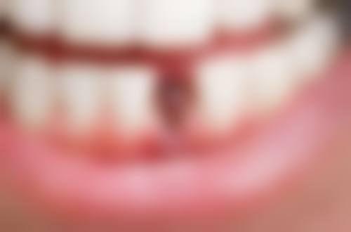 辽宁葫芦岛德诺牙博士口腔门诊部2026价格表参考