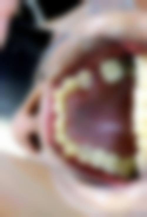 江西九江永修新航口腔口碑评价