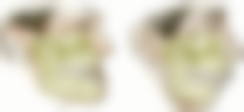 广东中山森尔泰丰店医院技术设备怎么样？