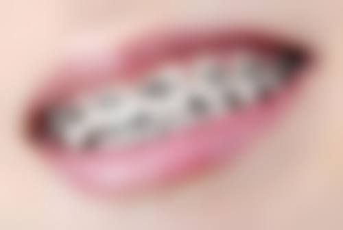 南京贝鹤雅康口腔医院地址及到院路线