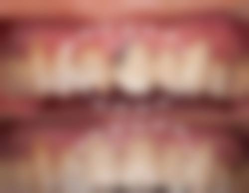 湖南省人民医院口腔科口碑评价