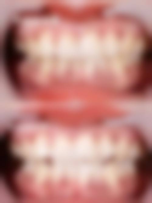 大连美尔口腔（万达门诊）医生团队解析