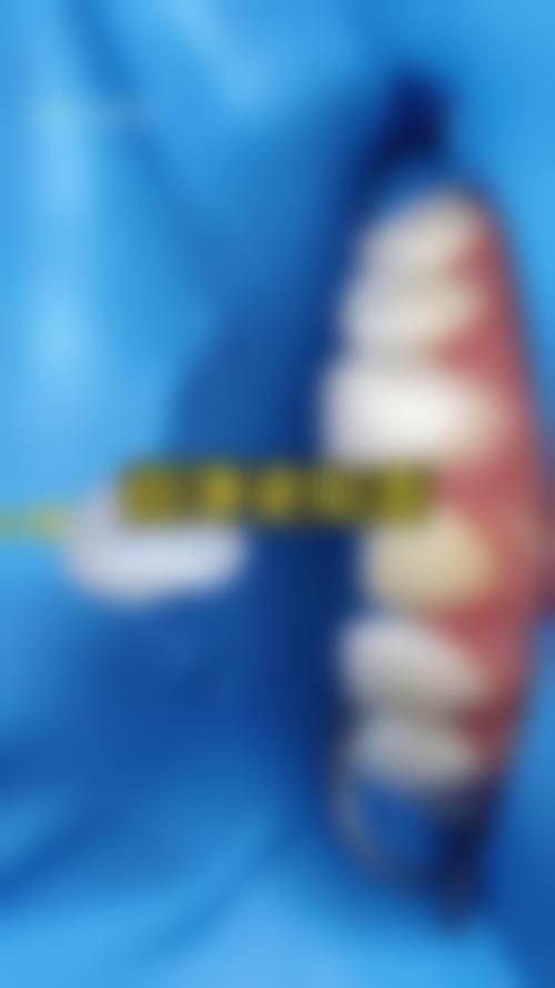 广东深圳黄志华口腔技术设备怎么样?