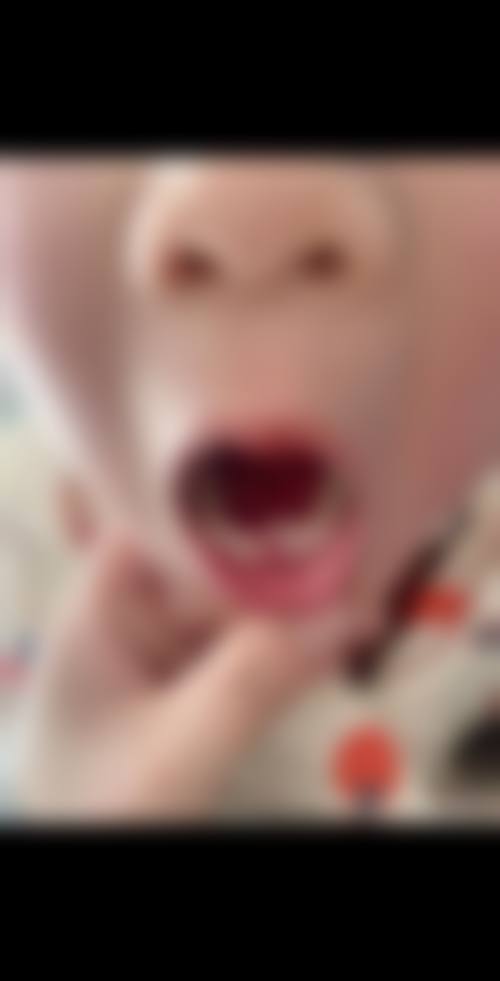 河南周口沈丘刚成口腔医生团队解析