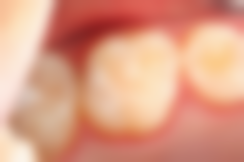 河南周口沈丘刚成口腔擅长项目有哪些？