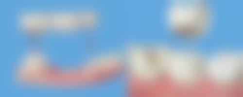 禹州亿达口腔口碑评价