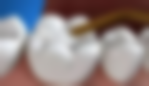 内蒙古巴彦淖尔喜爱口腔医生团队解析