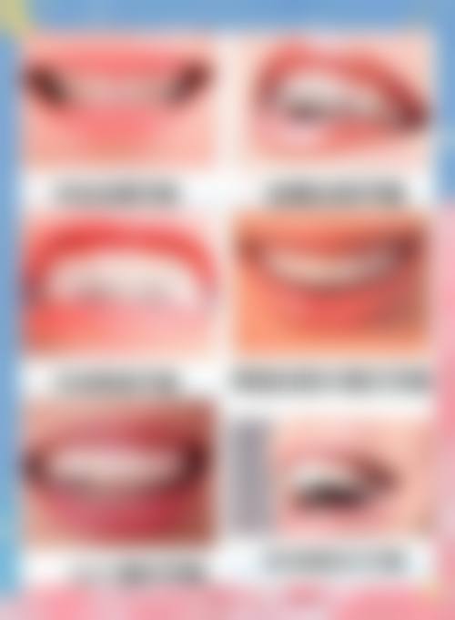 上海瑞欧齿科(安缦江桥店)擅长项目有哪些？