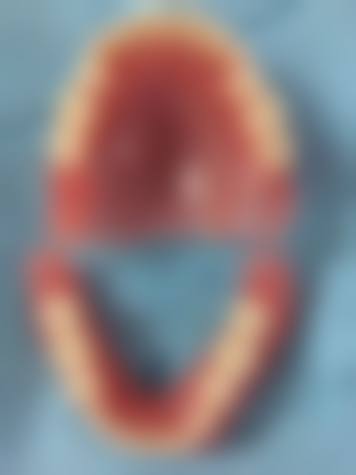 深圳牙牙乐口腔诊所口碑评价