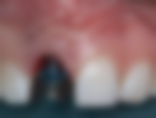 上海泰康拜博青尔口腔门诊部擅长项目有哪些?