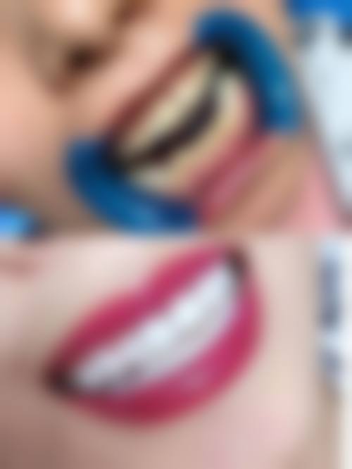 广东汕头丽如口腔技术设备怎么样?