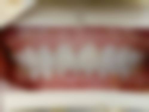 福州海狸家口腔(台江附一店)2026价格表参考