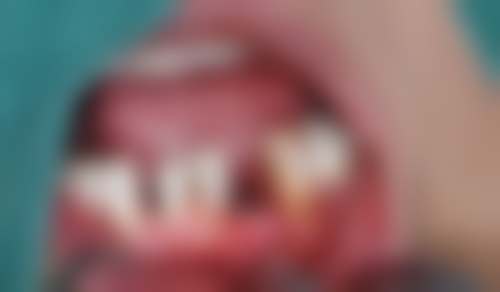 刘素娥预约方式及价格表