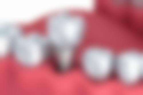 杭州牙科医院义乌口腔2026价格表参考