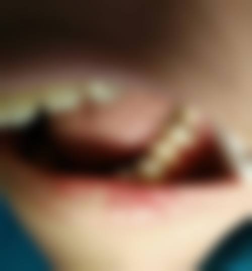 宁德市中医院口腔科擅长项目有哪些？