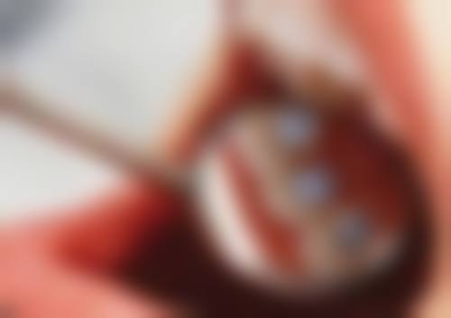 孔超擅长项目列表