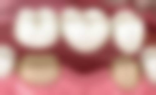 北京西尔口腔(石景山分院)医生团队解析