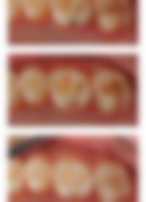 广东清远英德德康口腔交通攻略