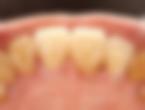 广东清远英德德康口腔技术设备怎么样?