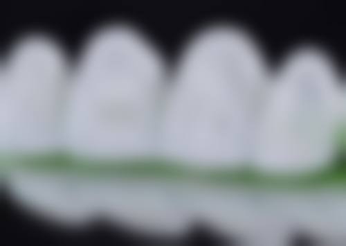 晋中榆次莱特口腔技术设备怎么样？