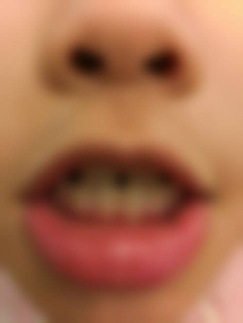 刘素娥预约方式及价格表