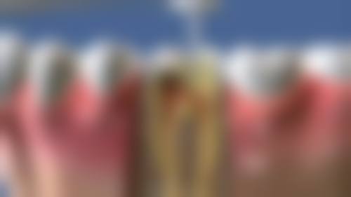 广东广州臻睿口腔诊所2026价格表参考