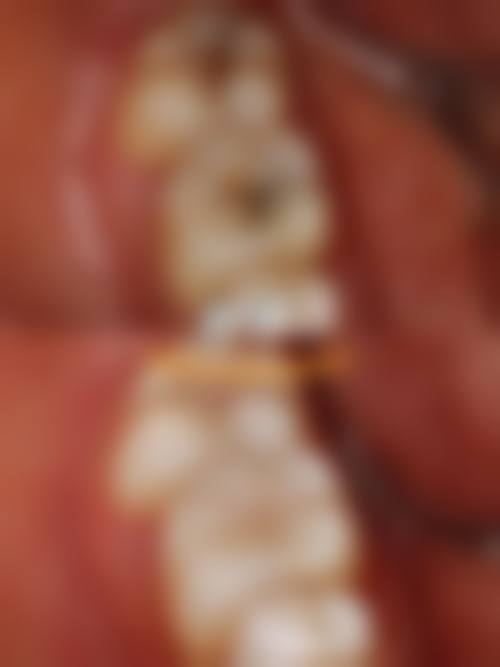 广东河源东源翁资生口腔诊所口碑评价