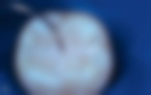 泰州玲珑口腔门诊擅长项目有哪些?