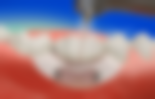 宁波德心口腔门诊部(鄞州店)地址及到院路线