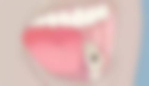 中山清贵口腔诊所擅长项目有哪些?