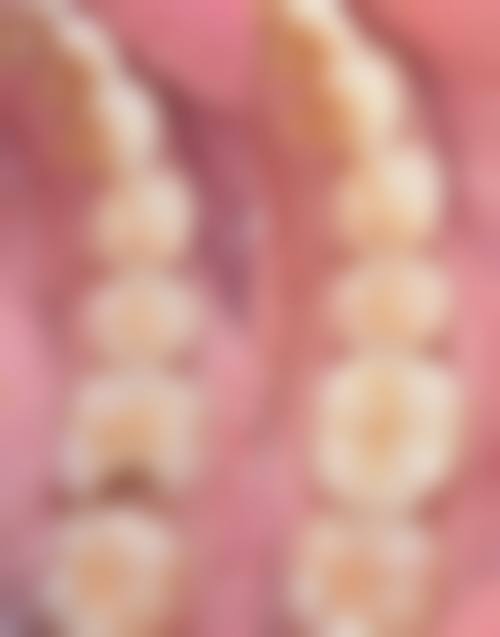 盐城陈荣庆口腔口碑评价