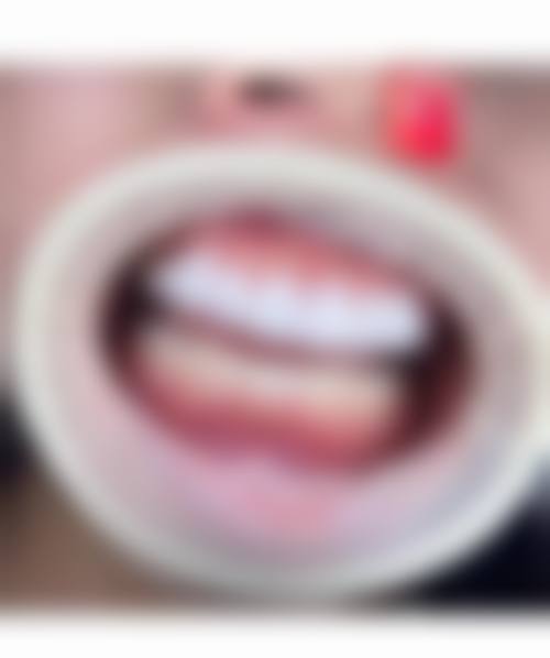 深圳同步齿科(同和门诊)医生团队解析