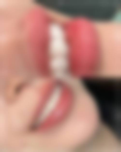 广东深圳科易白口腔门诊部擅长项目有哪些?