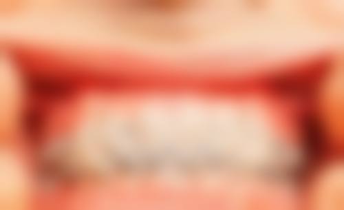 余姚康雅口腔医生团队解析