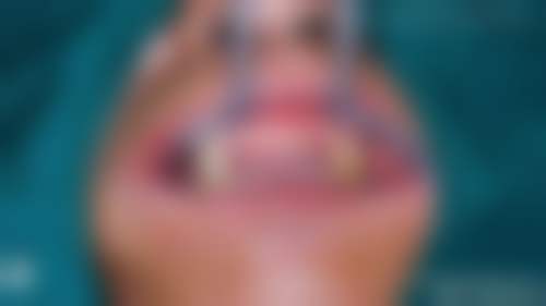 杭州口腔医院(紫金港院区)医生团队解析