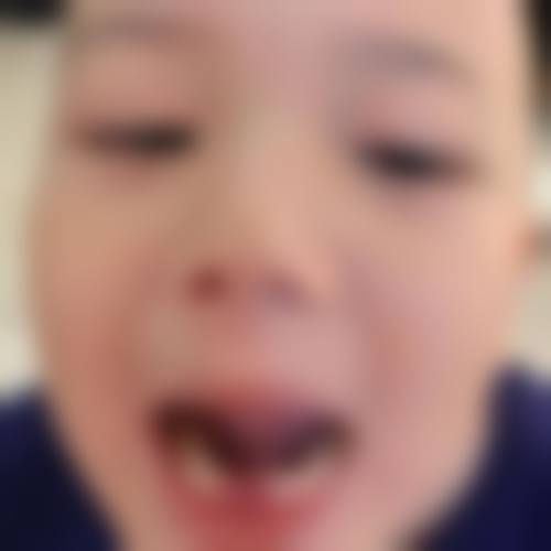 深圳河马口腔诊所擅长项目有哪些?