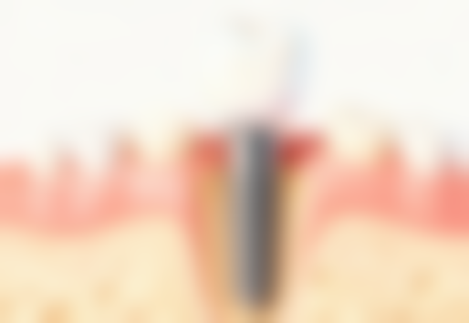 成都瑞泰口腔(世纪城店)2026价格表参考