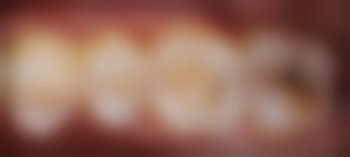 上海泰康拜博口腔(晶耀前滩店)2026价格表参考