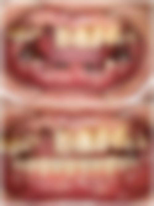 白银玉洁口腔诊所擅长项目有哪些？